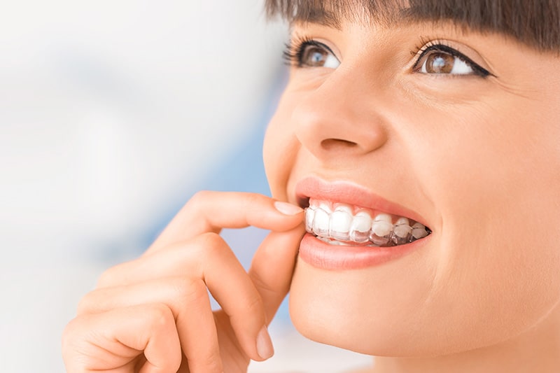 Invisalign in Fullerton